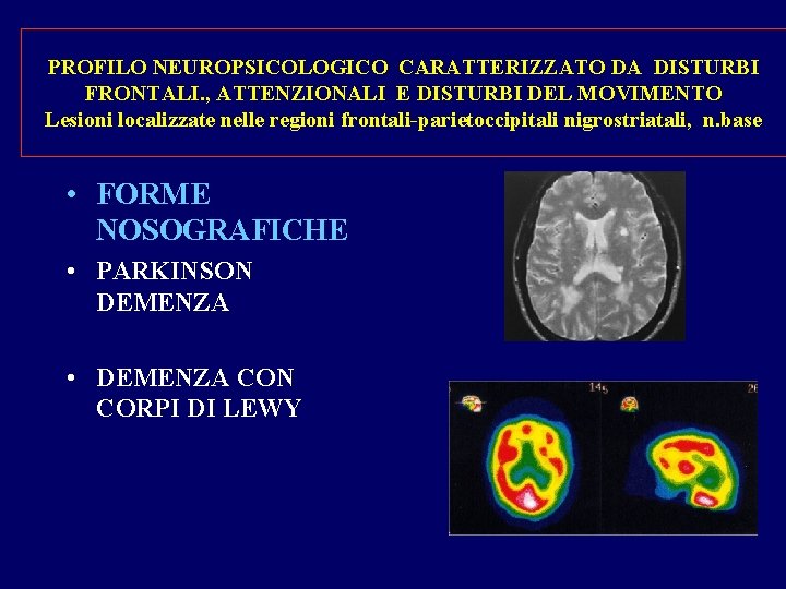 PROFILO NEUROPSICOLOGICO CARATTERIZZATO DA DISTURBI FRONTALI. , ATTENZIONALI E DISTURBI DEL MOVIMENTO Lesioni localizzate