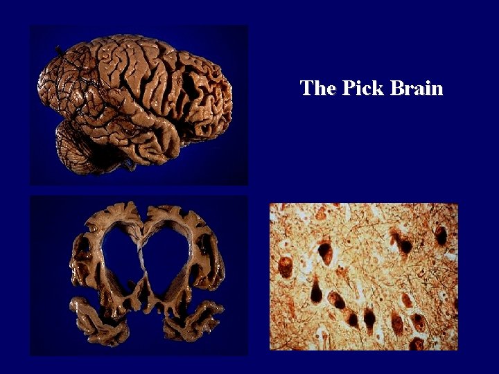 The Pick Brain 