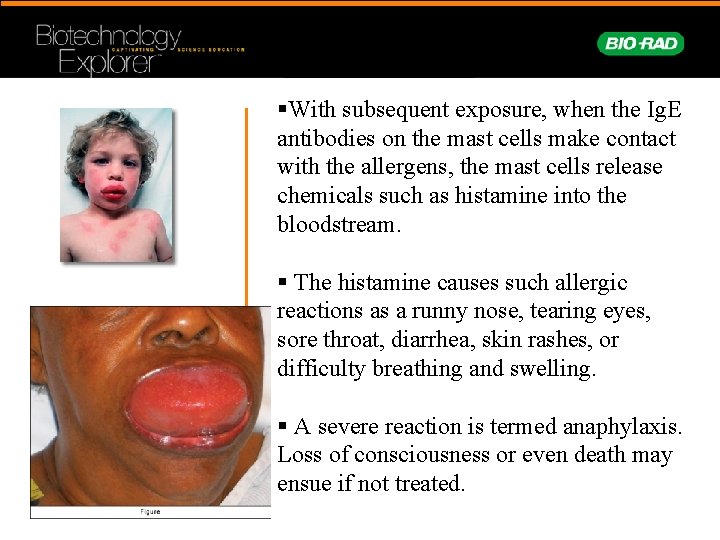 §With subsequent exposure, when the Ig. E antibodies on the mast cells make contact