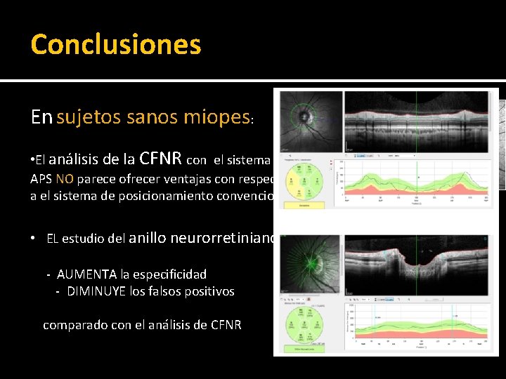 Conclusiones En sujetos sanos miopes: • El análisis de la CFNR con el sistema