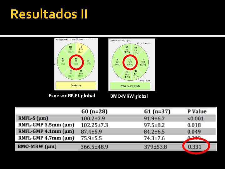 Resultados II Espesor RNFL global BMO-MRW global 