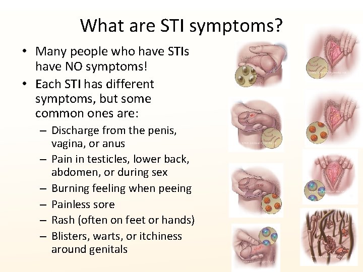 What are STI symptoms? • Many people who have STIs have NO symptoms! •