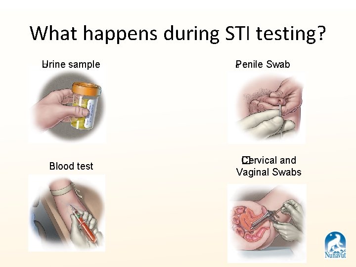 What happens during STI testing? Urine sample � Blood test � Penile Swab �