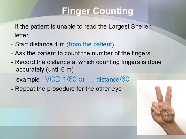 Finger Counting - If the patient is unable to read the Largest Snellen letter