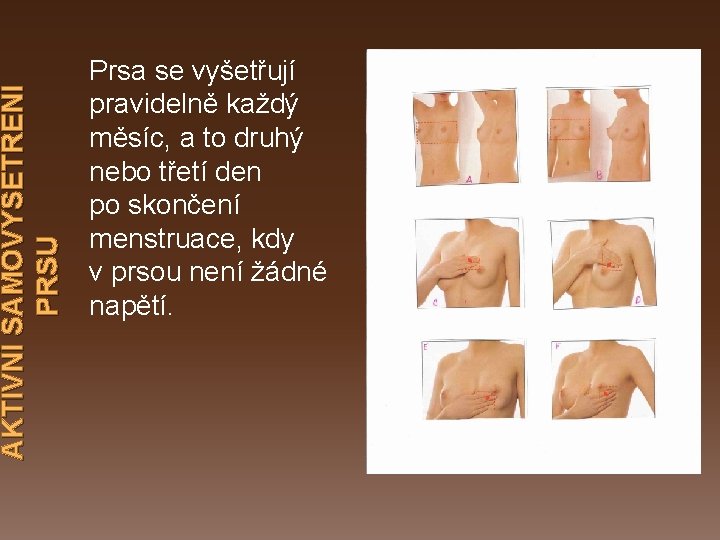  AKTIVNÍ SAMOVYŠETŘENÍ PRSU Prsa se vyšetřují pravidelně každý měsíc, a to druhý nebo