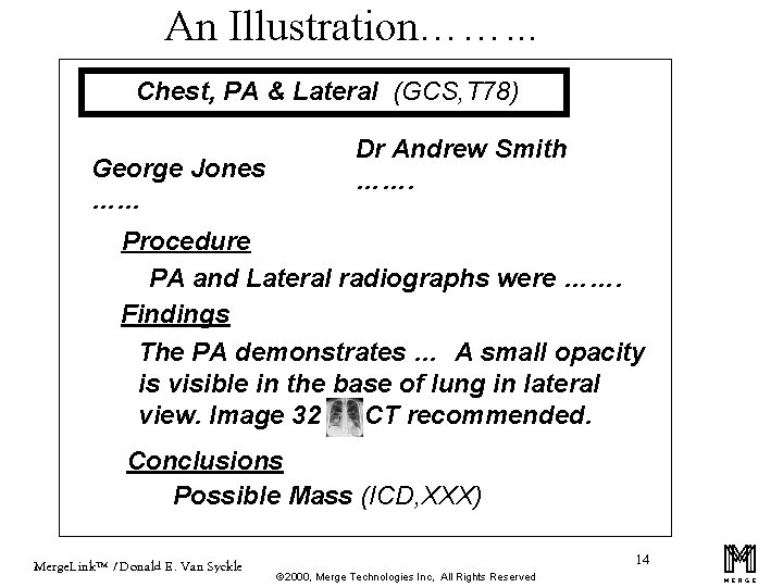 An Illustration……. . . Chest, PA & Lateral (GCS, T 78) George Jones ….