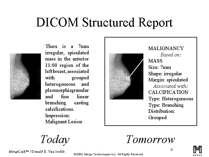 DICOM Structured Report There is a 7 mm irregular, spiculated mass in the anterior