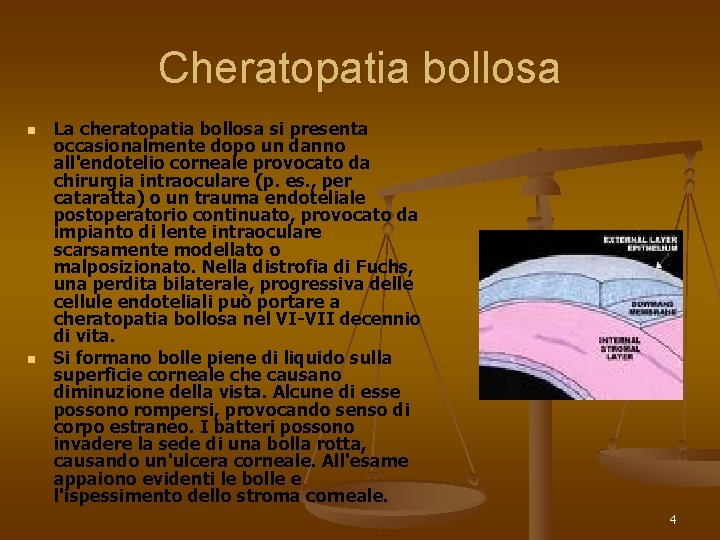 Cheratopatia bollosa n n La cheratopatia bollosa si presenta occasionalmente dopo un danno all'endotelio