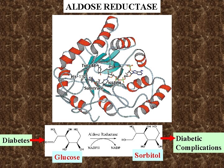 ALDOSE REDUCTASE Diabetes Glucose Sorbitol Diabetic Complications ALDOSE REDUCTASE Diabetes Glucose Sorbitol Diabetic Complications