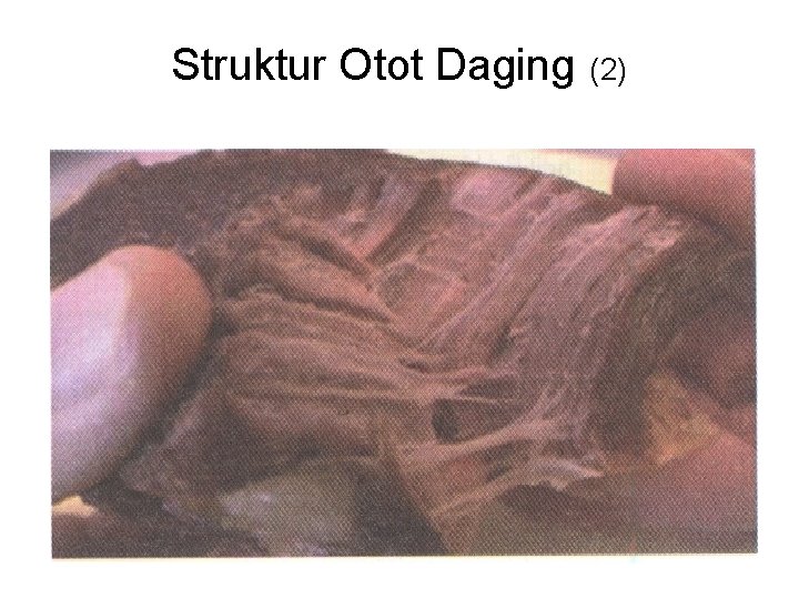 Struktur Otot Daging (2) 