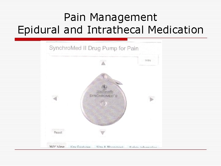 Pain Management Epidural and Intrathecal Medication Pain Management Epidural and Intrathecal Medication