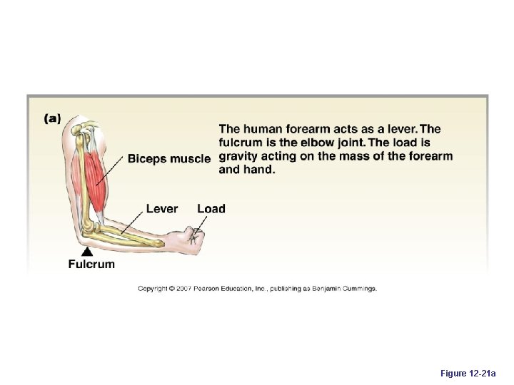 Figure 12 -21 a 