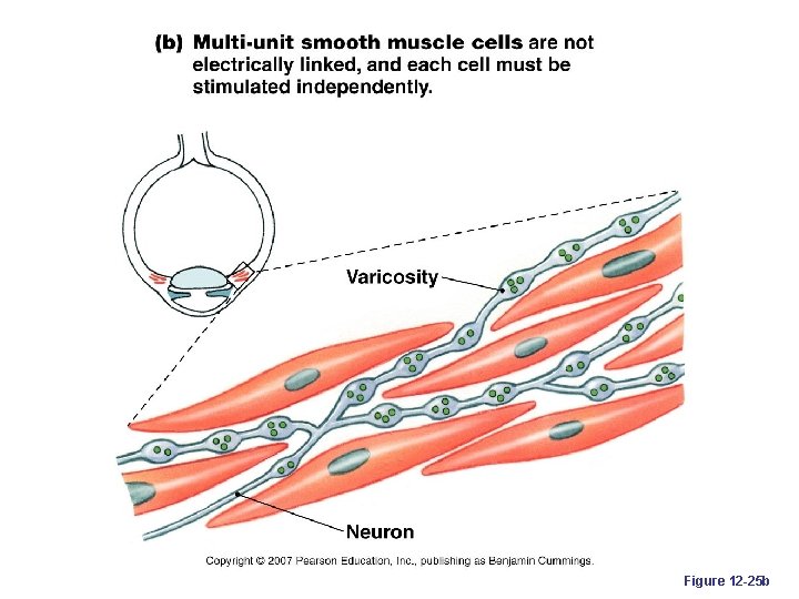 Figure 12 -25 b 