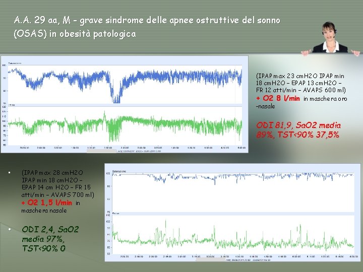 A. A. 29 aa, M - grave sindrome delle apnee ostruttive del sonno (OSAS)