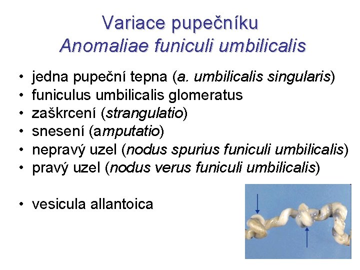 Variace pupečníku Anomaliae funiculi umbilicalis • • • jedna pupeční tepna (a. umbilicalis singularis)
