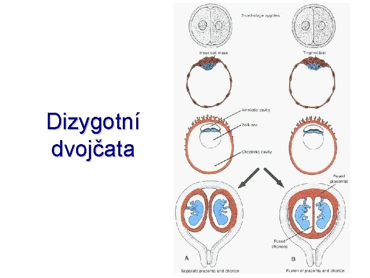 Dizygotní dvojčata 