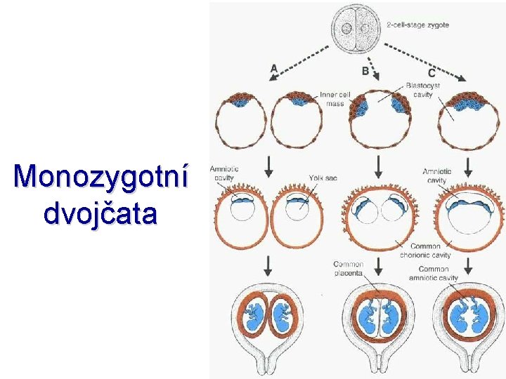 Monozygotní dvojčata 