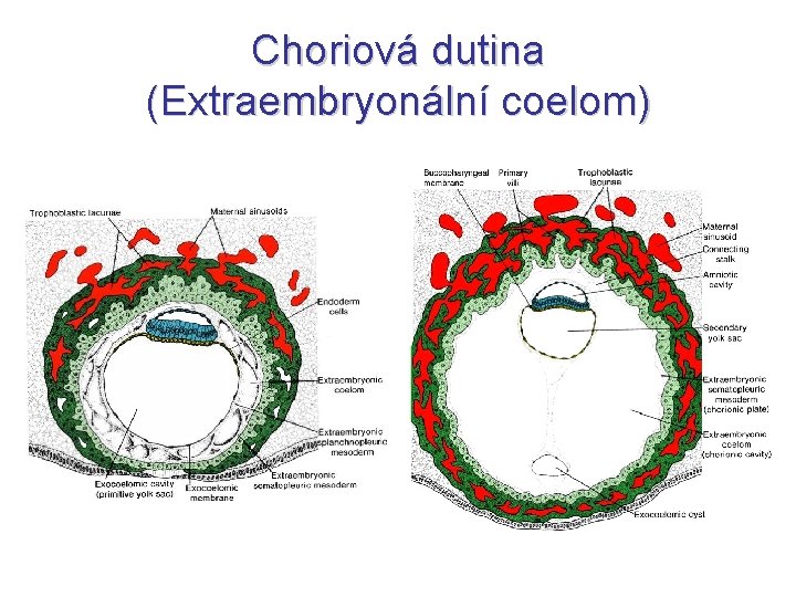 Choriová dutina (Extraembryonální coelom) 