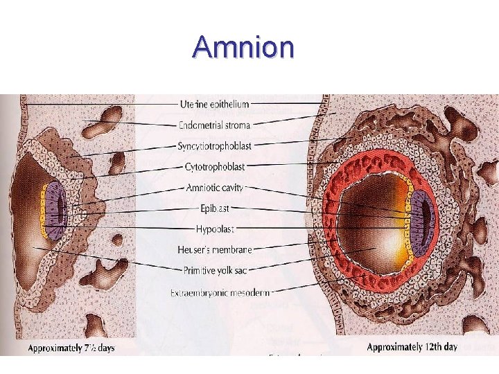 Amnion 