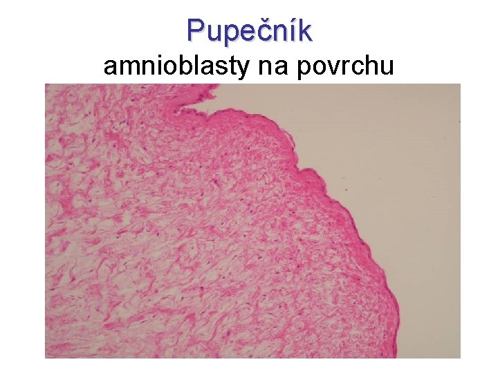 Pupečník amnioblasty na povrchu 