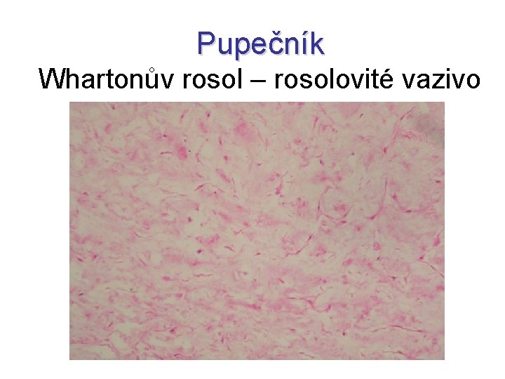 Pupečník Whartonův rosol – rosolovité vazivo 