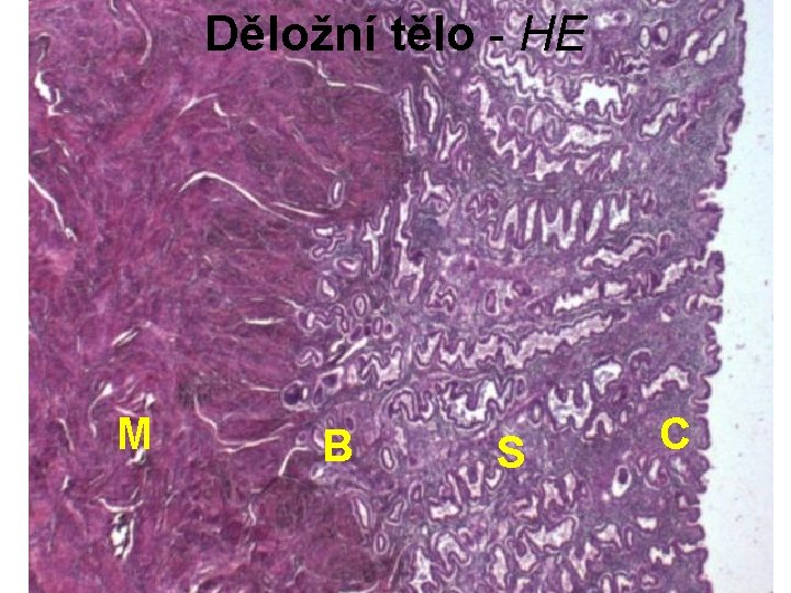 Děložní tělo - HE M B S C 