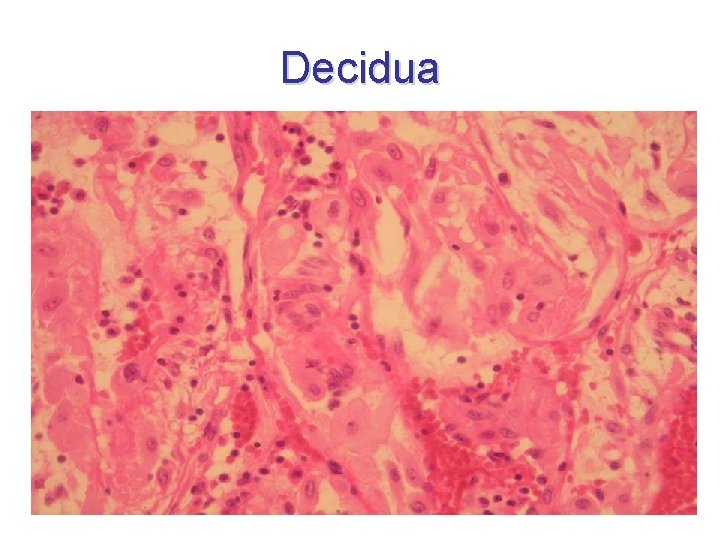 Decidua 