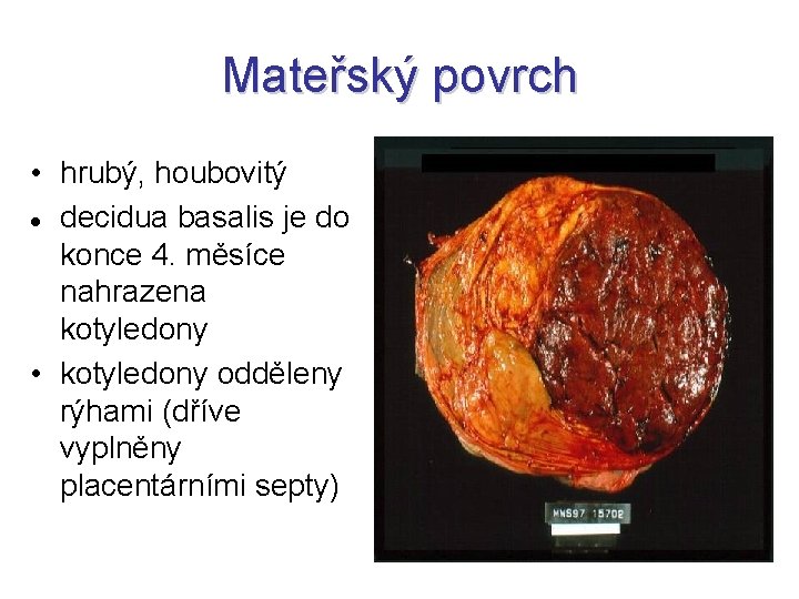 Mateřský povrch • hrubý, houbovitý decidua basalis je do konce 4. měsíce nahrazena kotyledony