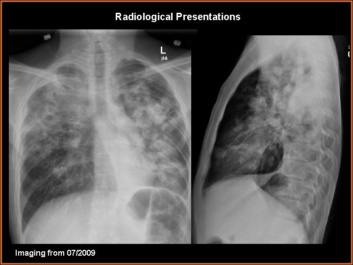 Radiological Presentations Imaging from 07/2009 