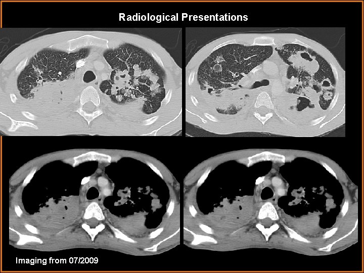 Radiological Presentations Imaging from 07/2009 