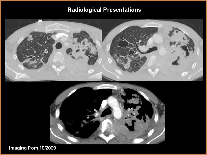 Radiological Presentations Imaging from 10/2009 