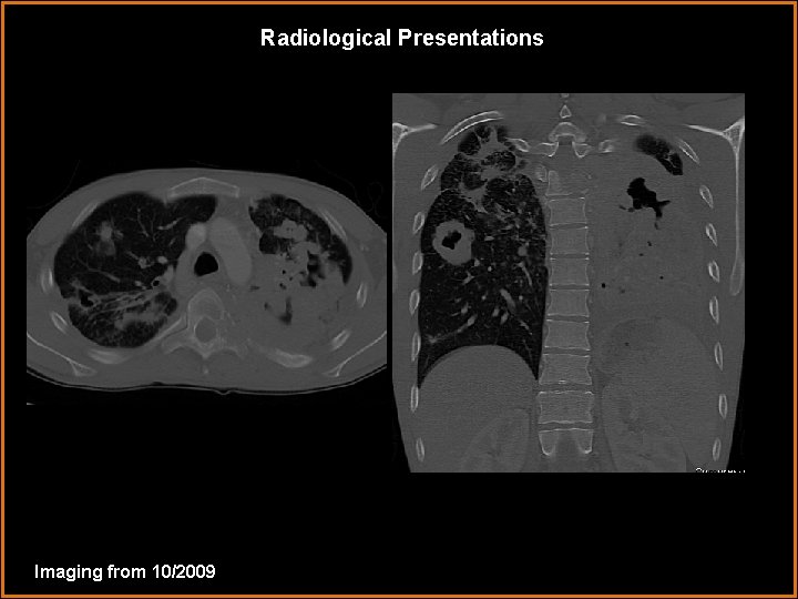 Radiological Presentations Imaging from 10/2009 