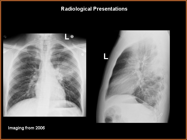 Radiological Presentations Imaging from 2006 