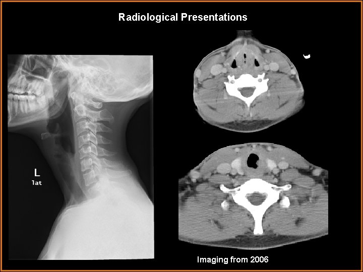 Radiological Presentations Imaging from 2006 