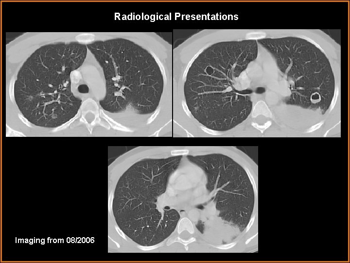 Radiological Presentations Imaging from 08/2006 