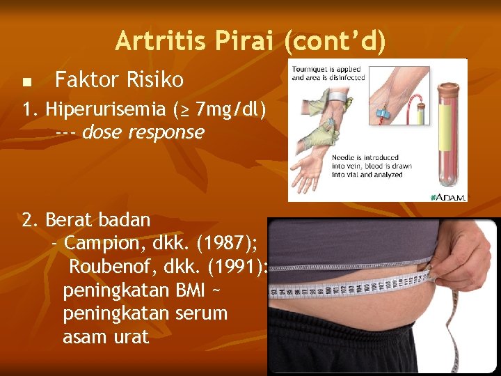 Artritis Pirai (cont’d) n Faktor Risiko 1. Hiperurisemia (≥ 7 mg/dl) --- dose response