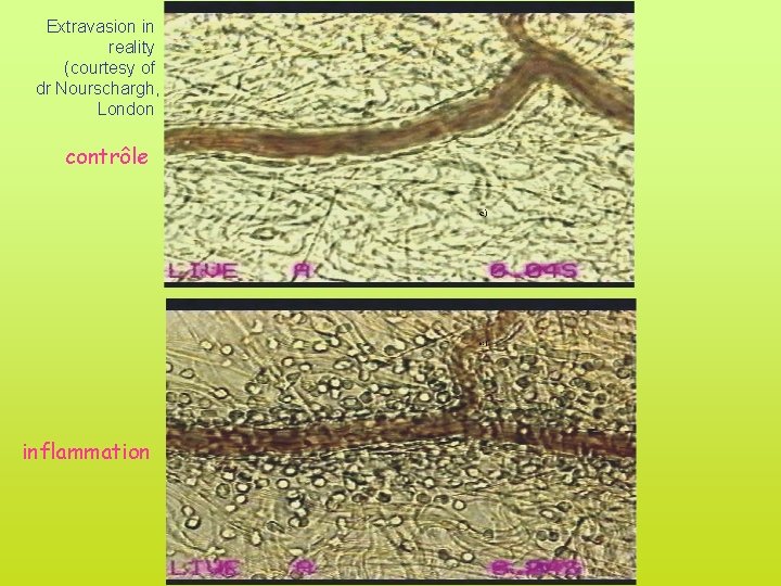 Extravasion in reality (courtesy of dr Nourschargh, London contrôle inflammation 