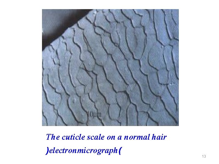 The cuticle scale on a normal hair )electronmicrograph( 13 