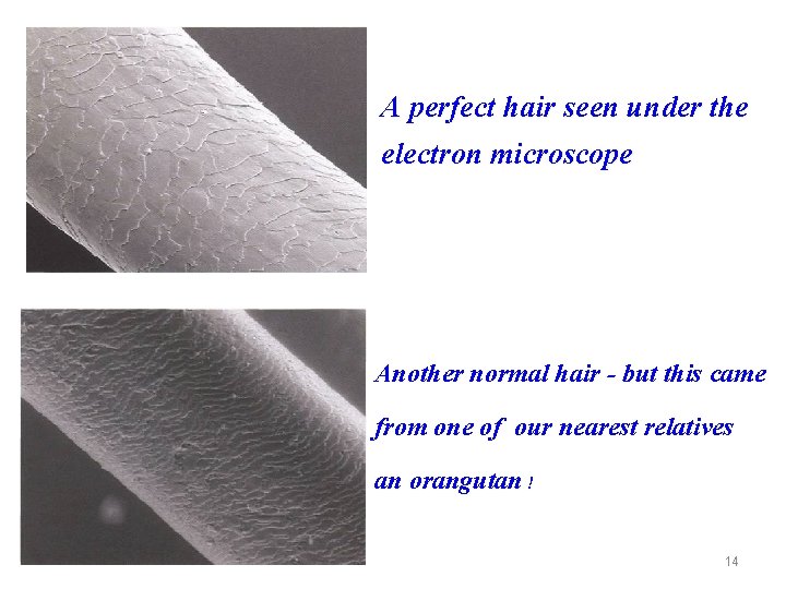 A perfect hair seen under the electron microscope Another normal hair - but this