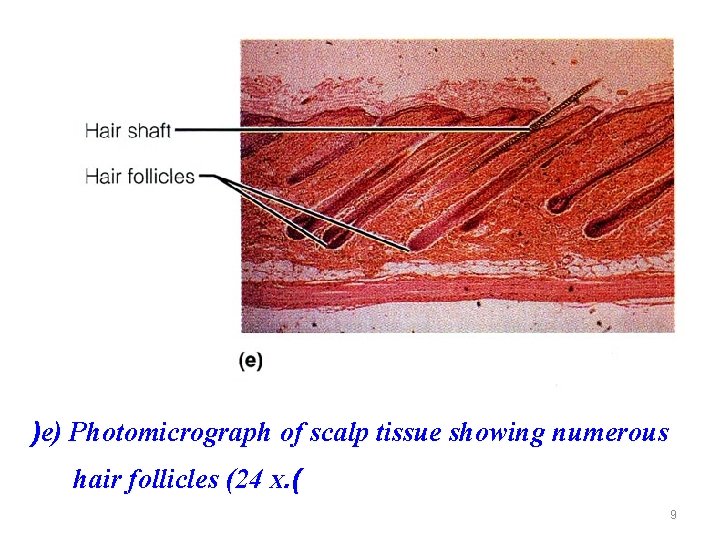 )e) Photomicrograph of scalp tissue showing numerous hair follicles (24 X. ( 9 