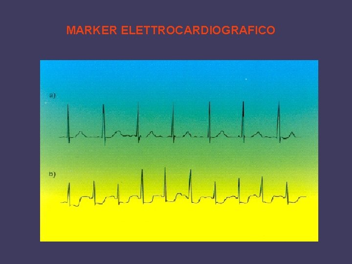 MARKER ELETTROCARDIOGRAFICO 