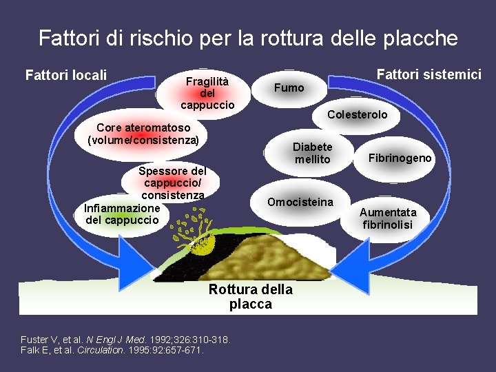 Fattori di rischio per la rottura delle placche Fattori locali Fragilità del cappuccio Core