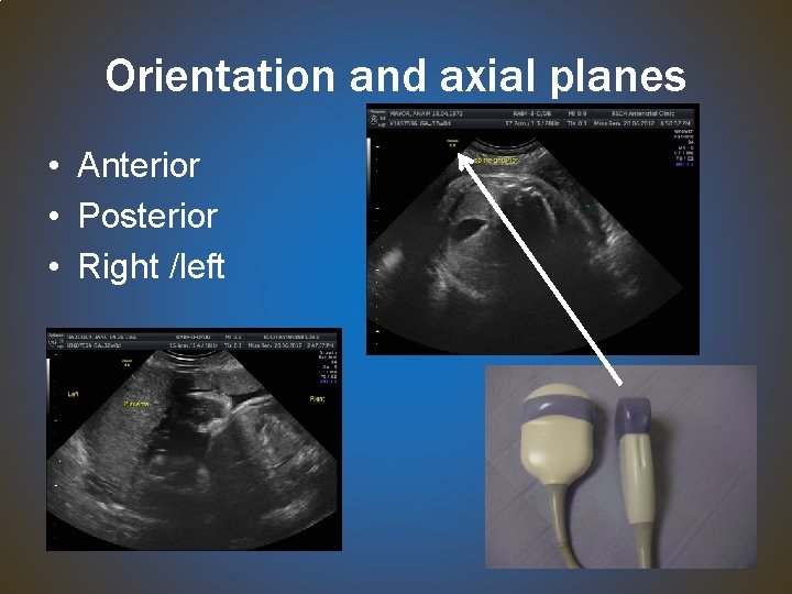 Orientation and axial planes • Anterior • Posterior • Right /left 