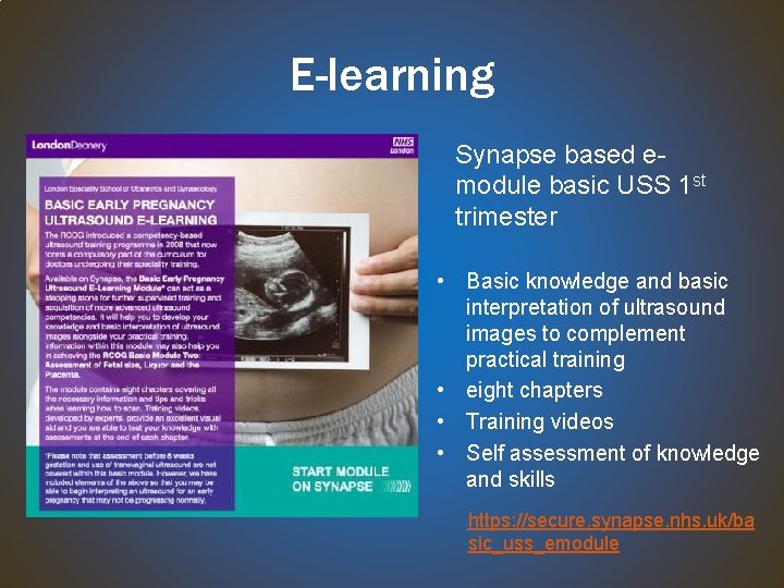 E-learning Synapse based emodule basic USS 1 st trimester • Basic knowledge and basic