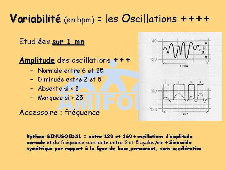Variabilité (en bpm) = les Oscillations ++++ Etudiées sur 1 mn Amplitude des oscillations Variabilité (en bpm) = les Oscillations ++++ Etudiées sur 1 mn Amplitude des oscillations