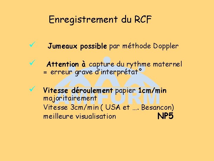 Enregistrement du RCF ü Jumeaux possible par méthode Doppler ü Attention à capture du Enregistrement du RCF ü Jumeaux possible par méthode Doppler ü Attention à capture du