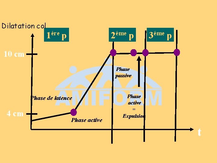 Dilatation col 1ére p 2éme p 3éme p 10 cm Phase passive Phase de Dilatation col 1ére p 2éme p 3éme p 10 cm Phase passive Phase de