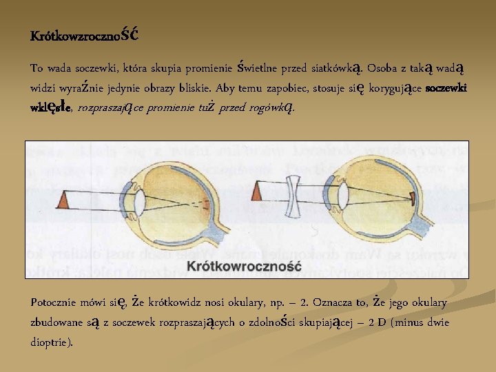 Krótkowzroczność To wada soczewki, która skupia promienie świetlne przed siatkówką. Osoba z taką wadą