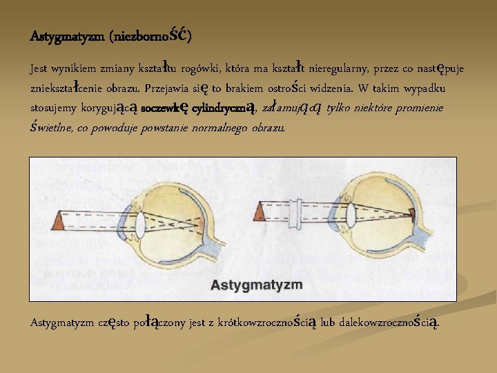 Astygmatyzm (niezborność) Jest wynikiem zmiany kształtu rogówki, która ma kształt nieregularny, przez co następuje