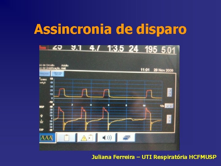 Assincronia de disparo Juliana Ferreira – UTI Respiratória HCFMUSP 